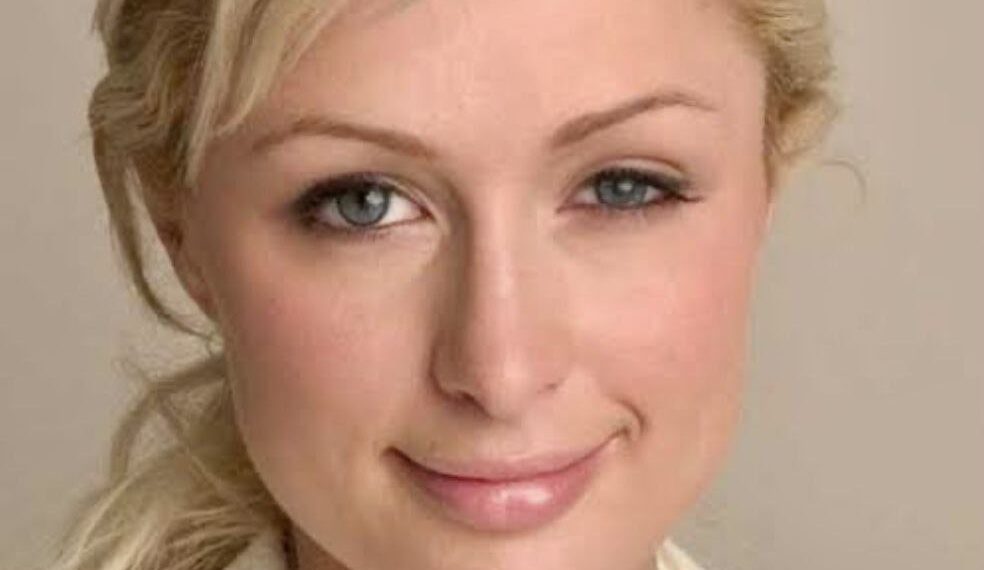 Looking through Ptosis