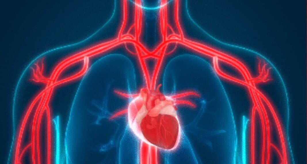Silent heart attack