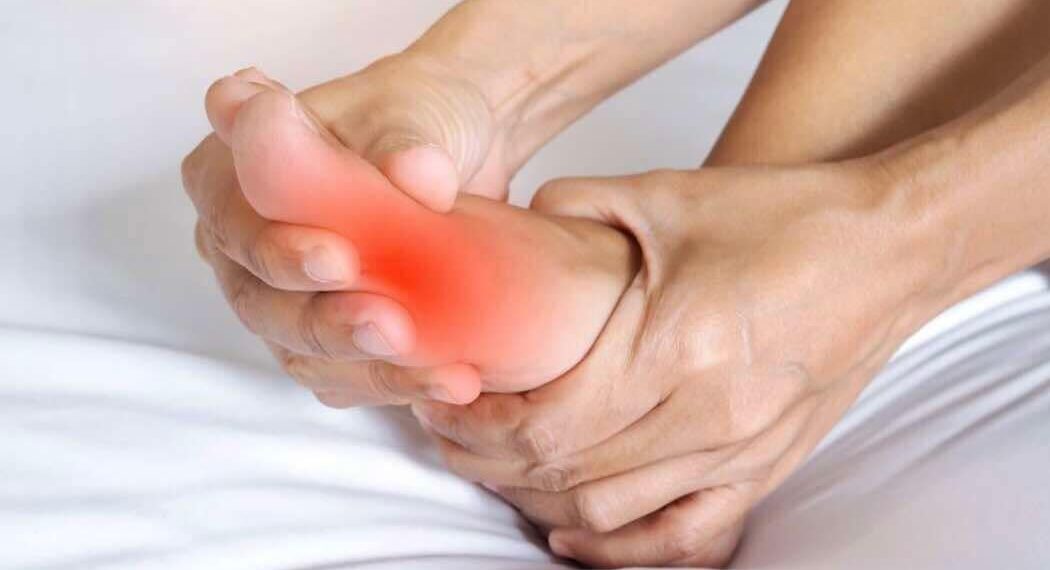 Natural Remedies for Gout Attacks